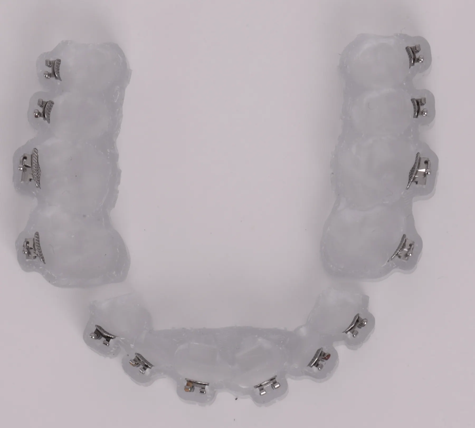 A SimplyBraces® ready-to-bond indirect bonding tray